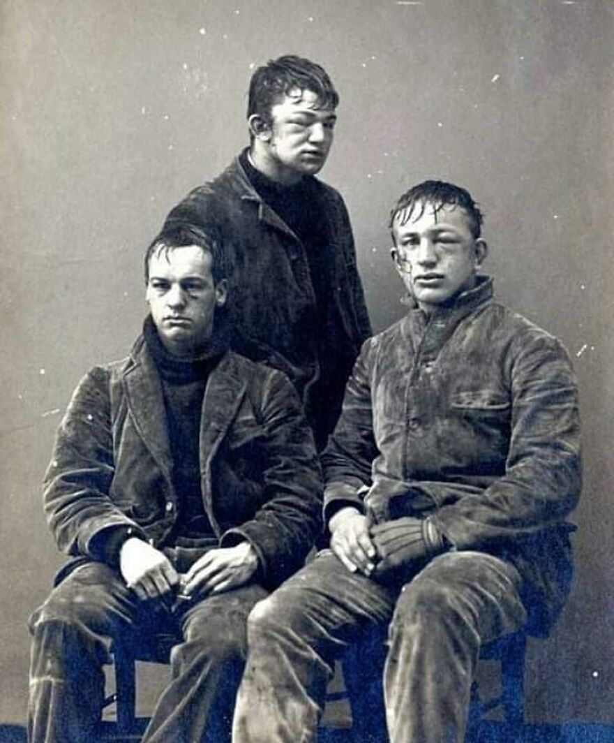 Fascinating photo of three rough-looking men with bruised faces, likely boxers, offering a glimpse into history.