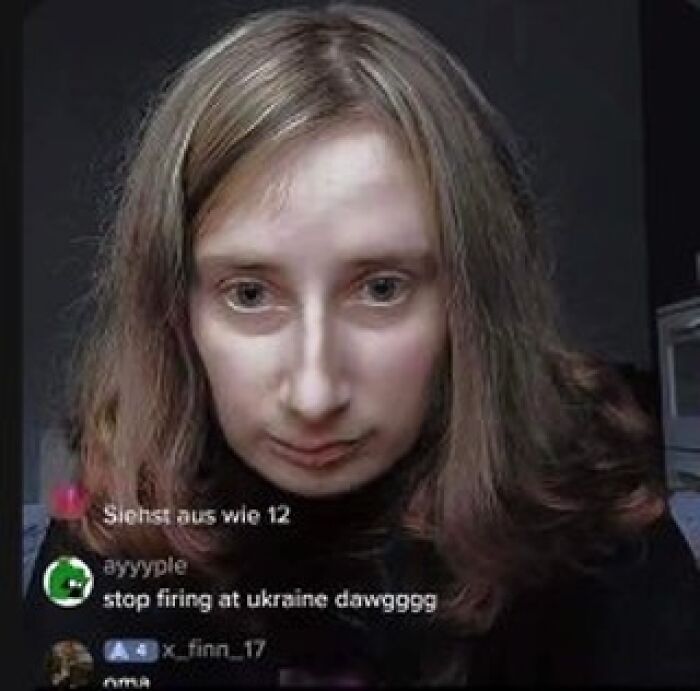 A woman with long hair looking seriously at the camera, with a comment thread visible below. This image highlights rare burns.
