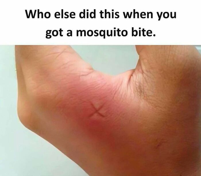 Close-up of a hand with a red mosquito bite and a memorable ’90s meme marking an X on the skin for relief.