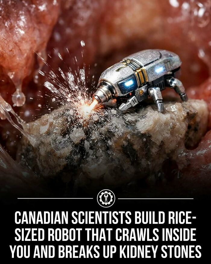 Rice-sized robot crawling inside to break up kidney stones, showcasing how everything is made with advanced technology.