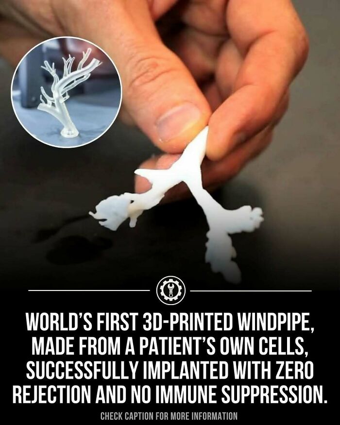 Hand holding world’s first 3D-printed windpipe made from patient’s cells showing innovative how everything is made technology.
