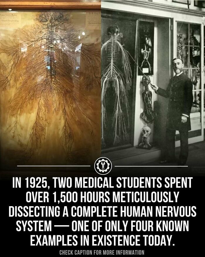 Medical students meticulously dissecting a complete human nervous system, showcasing fascinating facts on how everything is made.