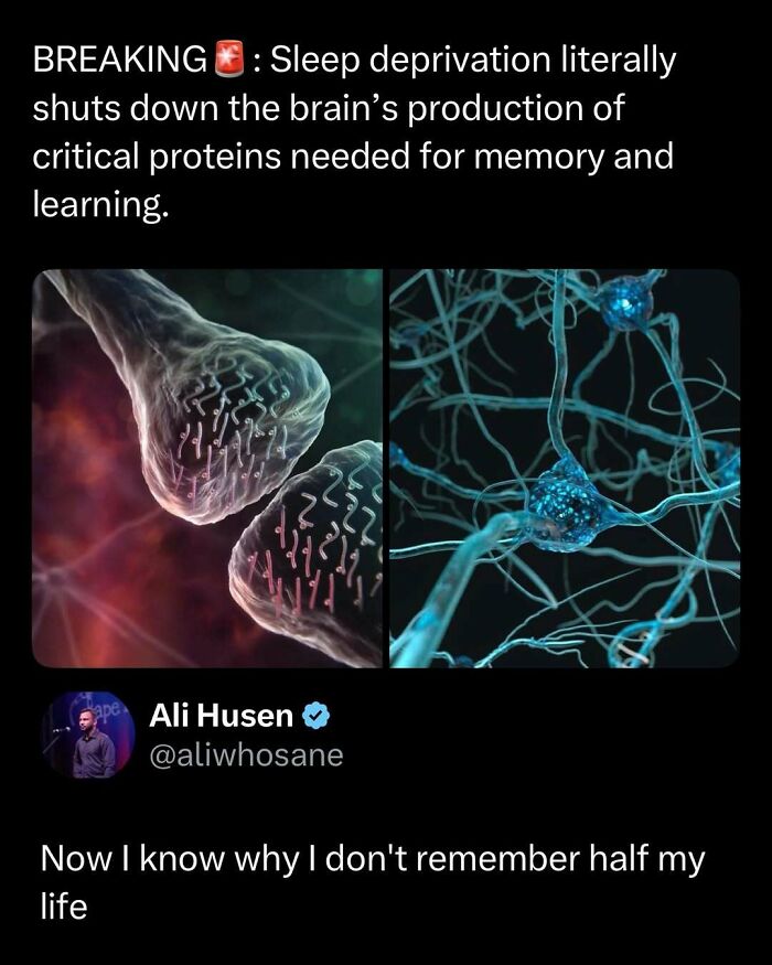 Sleep deprivation impact on brain neurons shown in scientific images in a funny and interesting post format.