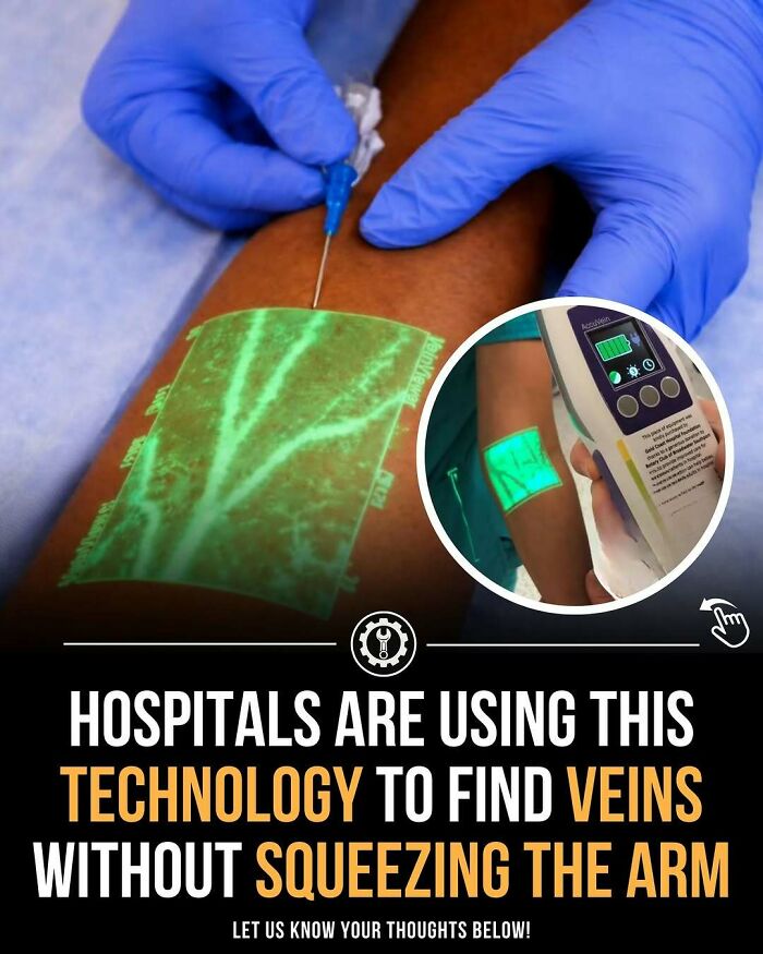 Medical technology displays veins on skin to help hospitals find veins without squeezing the arm during procedures.