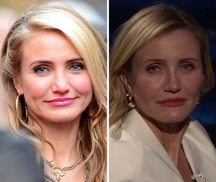 A visão simples de Cameron Diaz sobre Jimmy Fallon desperta um grande debate sobre cirurgia plástica