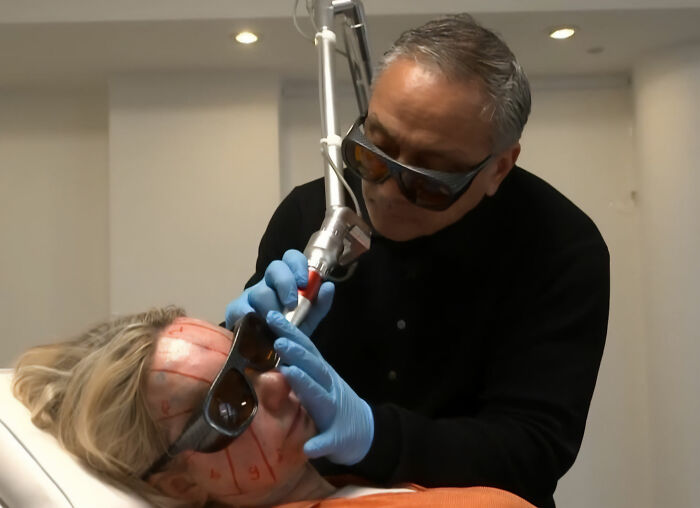 Man in protective glasses performing laser tattoo removal on 52-year-old woman's face with visible tattoo markings. Man in protective glasses performing laser tattoo removal on 52-year-old woman's face with visible tattoo markings.