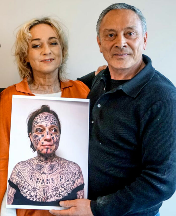 Woman holding tattoo removal transformation photo showing name tattoos covering skin after forced 250 tattoos. Woman holding tattoo removal transformation photo showing name tattoos covering skin after forced 250 tattoos.