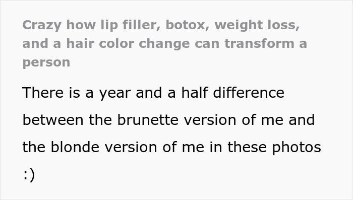 Mulher mostra sua transformação maluca, as pessoas não conseguem acreditar: "Preenchimento labial, botox, perda de peso"