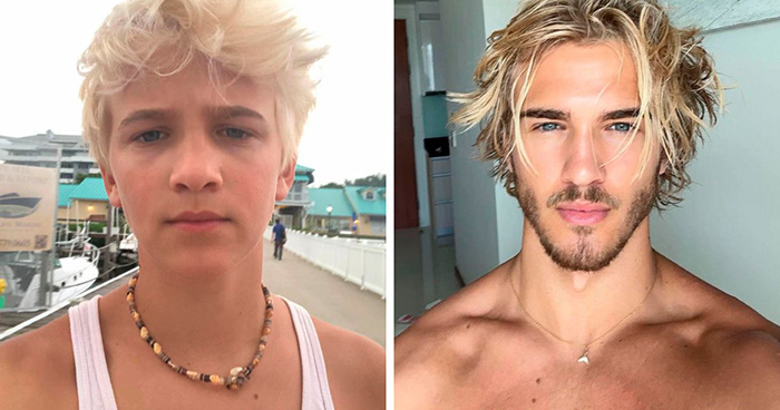 From Bone Smashing To Chin Extensions, Here Are Before-And-After Collages Of “Looksmaxxing” Influencers
