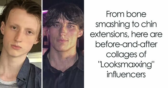 From Bone Smashing To Chin Extensions, Here Are Before-And-After Collages Of “Looksmaxxing” Influencers