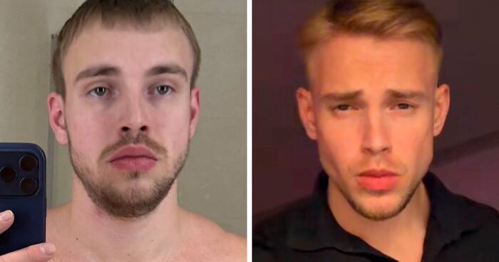 From Bone Smashing To Chin Extensions, Here Are Before-And-After Collages Of “Looksmaxxing” Influencers