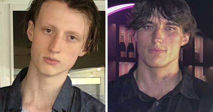 From Bone Smashing To Chin Extensions, Here Are Before-And-After Collages Of “Looksmaxxing” Influencers