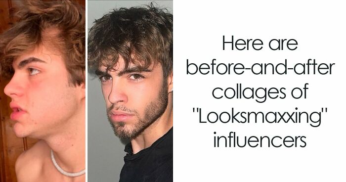 From Bone Smashing To Chin Extensions, Here Are Before-And-After Collages Of “Looksmaxxing” Influencers