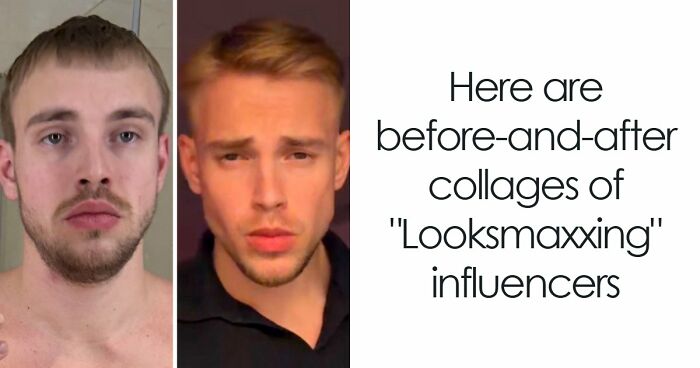 From Bone Smashing To Chin Extensions, Here Are Before-And-After Collages Of “Looksmaxxing” Influencers