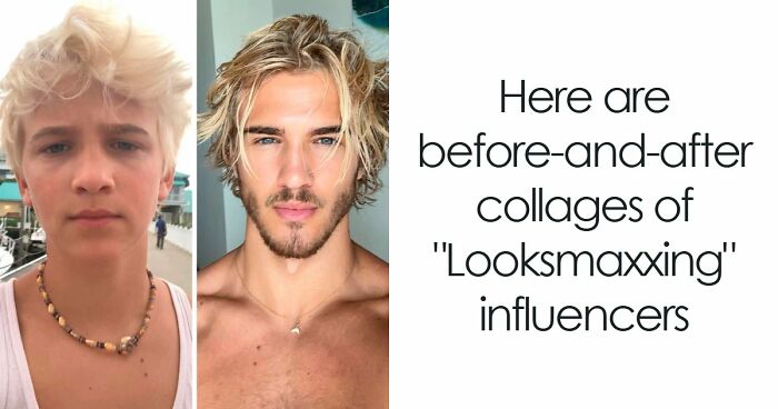 From Bone Smashing To Chin Extensions, Here Are Before-And-After Collages Of “Looksmaxxing” Influencers