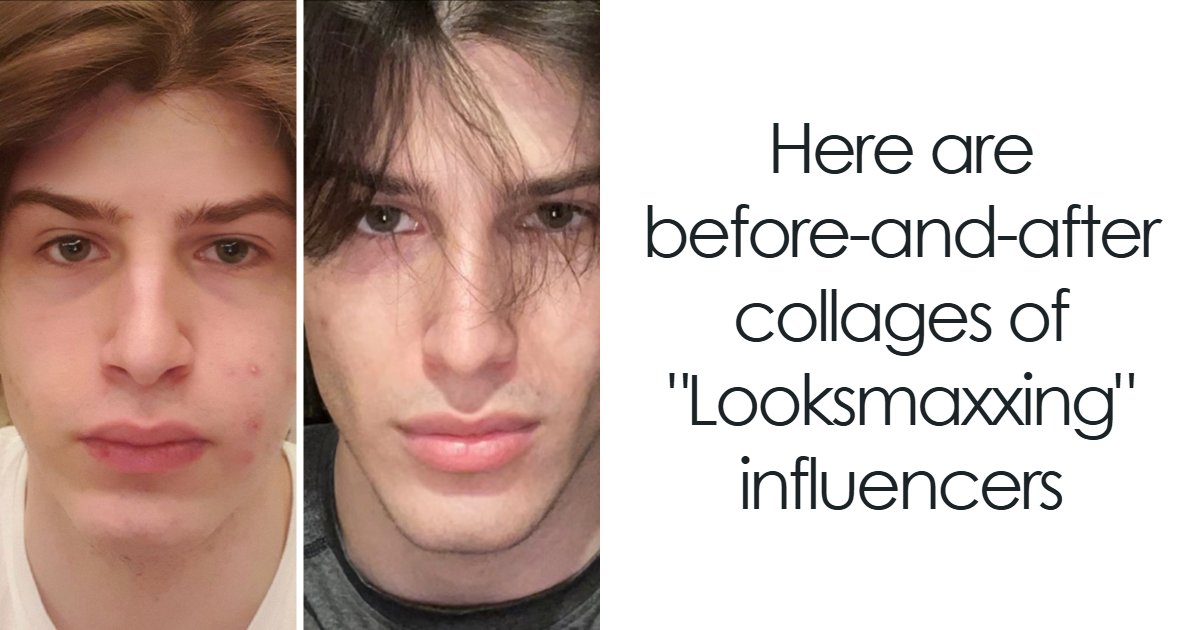From Bone Smashing To Chin Extensions, Here Are Before-And-After Collages Of "Looksmaxxing" Influencers - Bored Panda