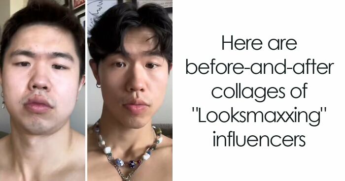 From Bone Smashing To Chin Extensions, Here Are Before-And-After Collages Of “Looksmaxxing” Influencers