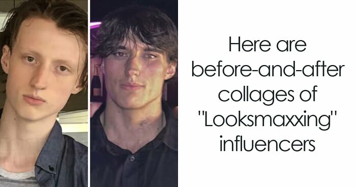 From Bone Smashing To Chin Extensions, Here Are Before-And-After Collages Of “Looksmaxxing” Influencers