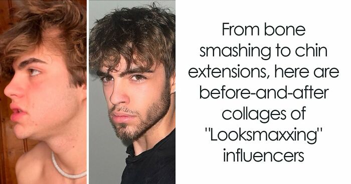 From Bone Smashing To Chin Extensions, Here Are Before-And-After Collages Of “Looksmaxxing” Influencers