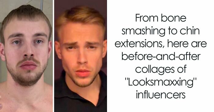 From Bone Smashing To Chin Extensions, Here Are Before-And-After Collages Of “Looksmaxxing” Influencers