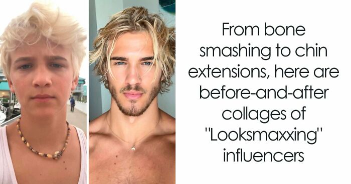 From Bone Smashing To Chin Extensions, Here Are Before-And-After Collages Of “Looksmaxxing” Influencers