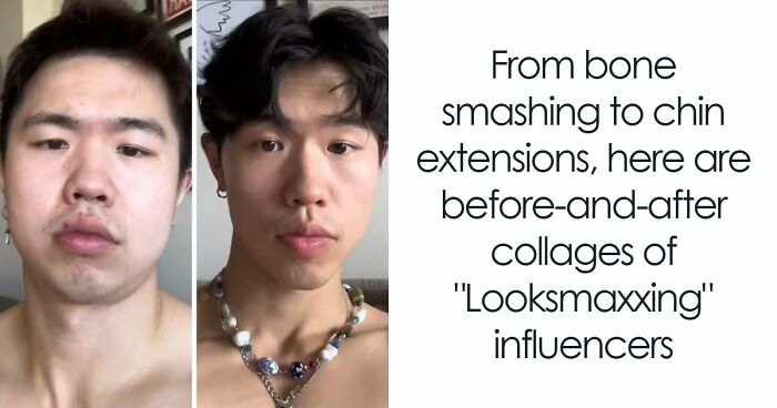 From Bone Smashing To Chin Extensions, Here Are Before-And-After Collages Of “Looksmaxxing” Influencers