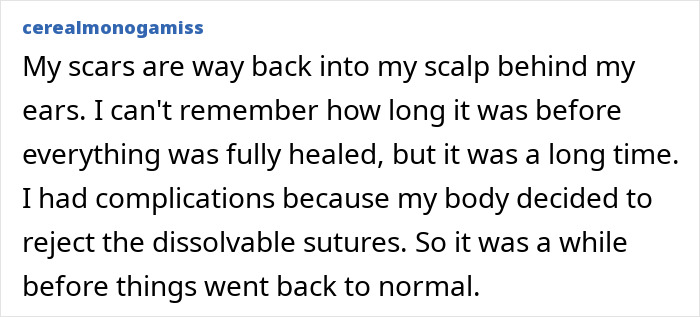 All The Signs Pointing To Your Coworker’s Secret Plastic Surgery, From Bat Ears To Bunny Nose And A Hairstyle Change All The Signs Pointing To Your Coworker’s Secret Plastic Surgery, From Bat Ears To Bunny Nose And A Hairstyle Change