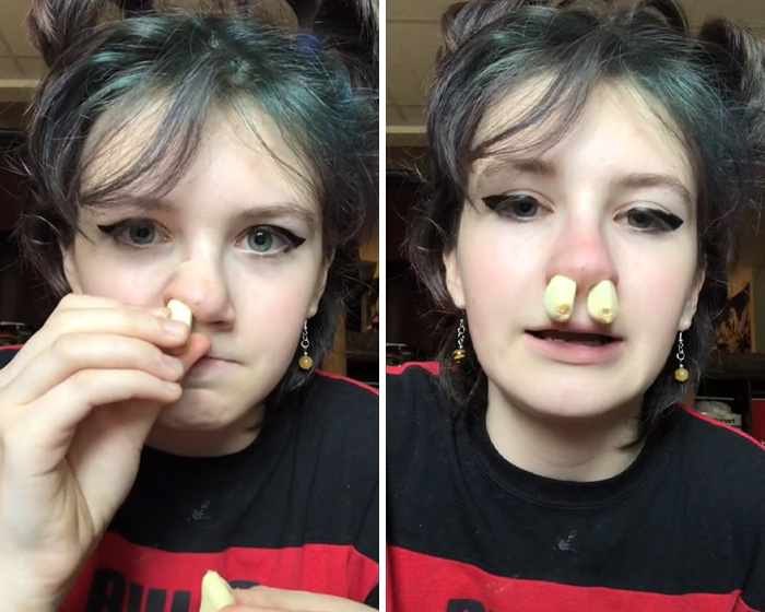 Brandi Glanville correu para atendimento de urgência depois de tentar a perigosa tendência médica do TikTok Brandi Glanville correu para atendimento de urgência depois de tentar a perigosa tendência médica do TikTok