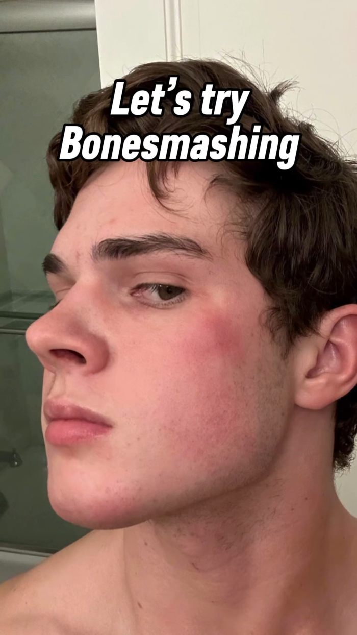 Médico emite alerta urgente após descobrir a realidade sombria por trás da tendência ‘Looksmaxxing’