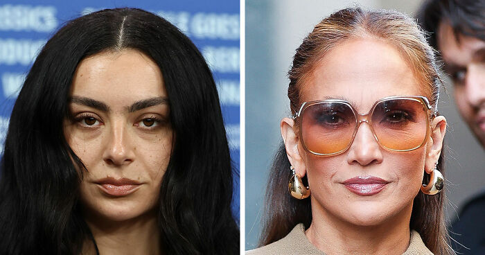 50+ Unfiltered Celebrity Photos That Show There’s No Such Thing As “Perfect” Skin