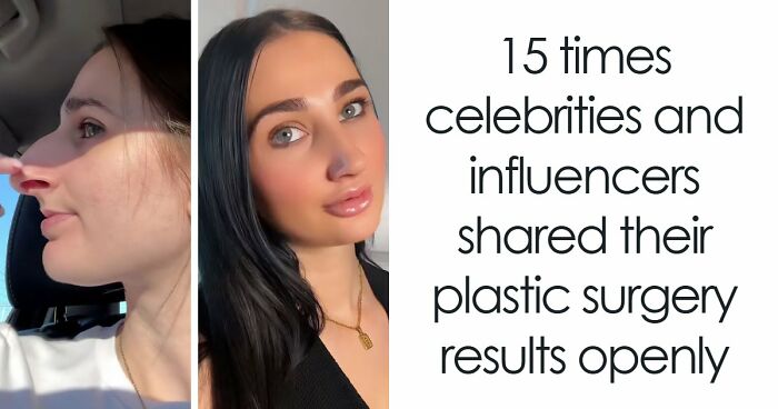 28 Before-And-After Animal Stories Shared By This Page That Show What Compassion Can Do