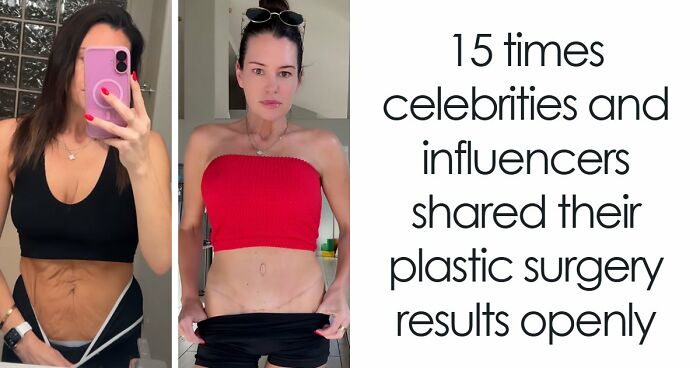 28 Before-And-After Animal Stories Shared By This Page That Show What Compassion Can Do