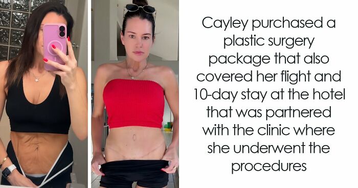 28 Before-And-After Animal Stories Shared By This Page That Show What Compassion Can Do