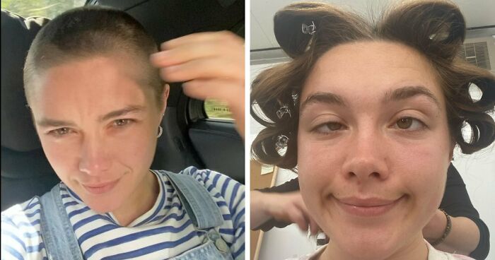 17 Bizarre Medical Problems And Mysteries That Catapulted People Into The News