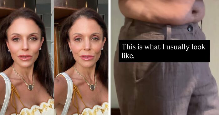 17 Bizarre Medical Problems And Mysteries That Catapulted People Into The News