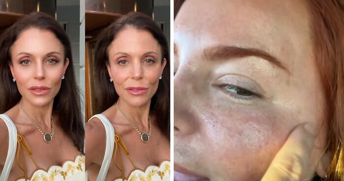 17 Bizarre Medical Problems And Mysteries That Catapulted People Into The News