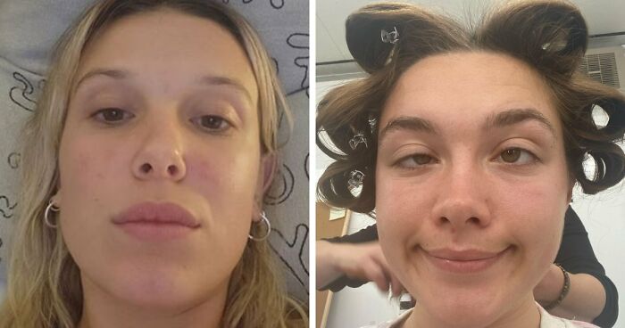 17 Bizarre Medical Problems And Mysteries That Catapulted People Into The News