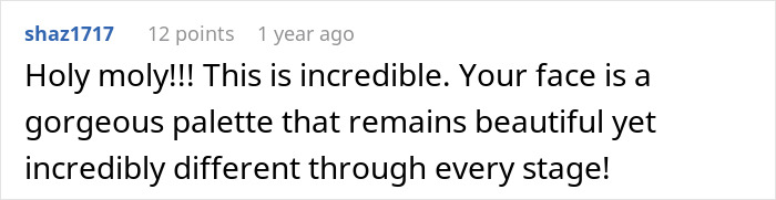 Woman Shows Her Crazy Transformation, People Can't Believe It: "Lip Fillers, Botox, Weight Loss"