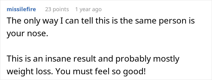 Woman Shows Her Crazy Transformation, People Can't Believe It: "Lip Fillers, Botox, Weight Loss"