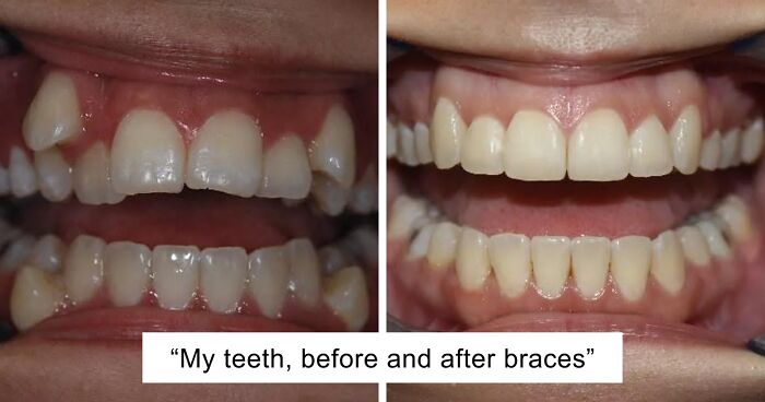 48 Side-By-Side Comparisons That Put The World Into Perspective (New Pics)