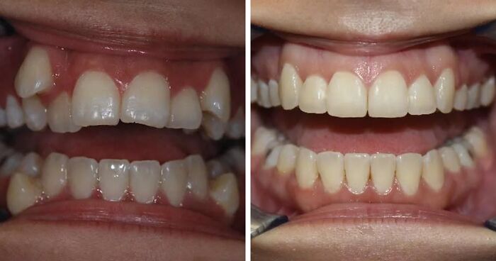 48 Side-By-Side Comparisons That Put The World Into Perspective (New Pics)