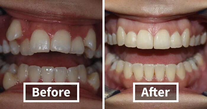 48 Side-By-Side Comparisons That Put The World Into Perspective (New Pics)