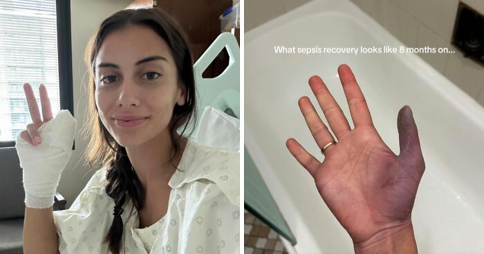 Young Woman Issues Urgent Warning About Going To Nail Salons After She Ended Up In The Hospital