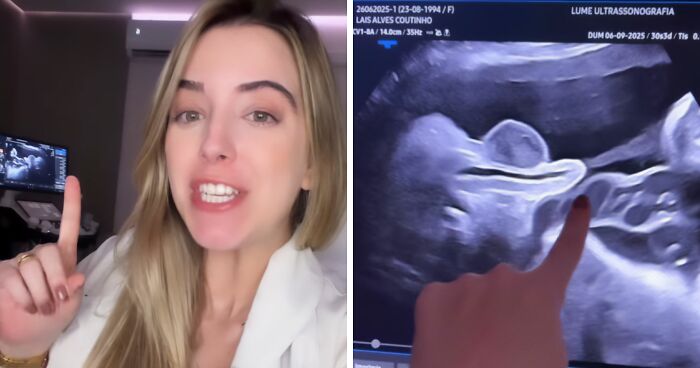 Pregnant Doctor Shows Her Own Baby Peeing Inside The Womb In Mind-Blowing Viral Video