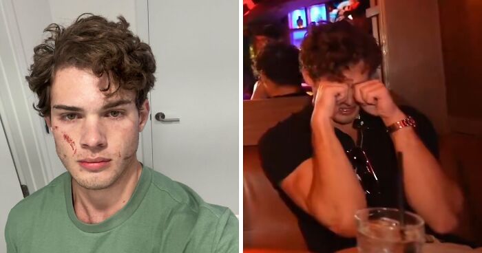 ‘Looksmaxxing’ Influencer Clavicular Breaks Silence After ‘Brutal’ Hospitalization Following Live Incident