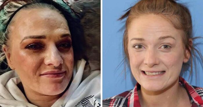 “Best Facial Harmonization I’ve Ever Seen”: 25 Before-And-Afters By A Plastic Surgeon Whose Work Went Viral