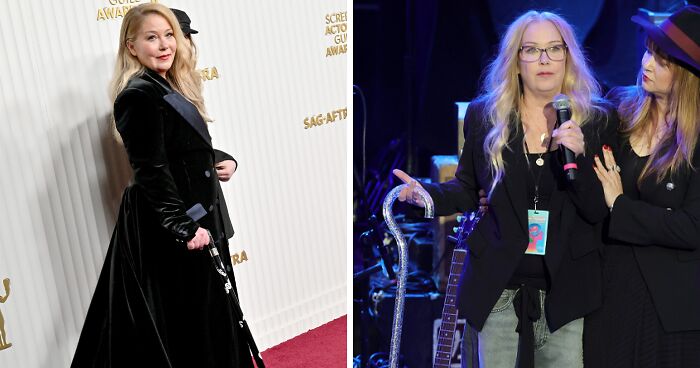 “Best Facial Harmonization I’ve Ever Seen”: 25 Before-And-Afters By A Plastic Surgeon Whose Work Went Viral