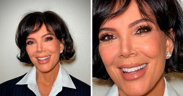 “Gravity Will Always Win”: Internet Reacts To Kris Jenner Reported Dissatisfaction With Her $100k Facelift