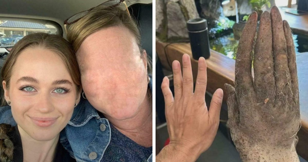 “Headless Woman”: Prepare To Have A Bad Night’s Sleep After Scrolling Through These 63 Creepy Pics