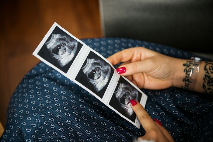 Person with tattoo and red nails holding ultrasound images, illustrating weird and interesting medical facts.